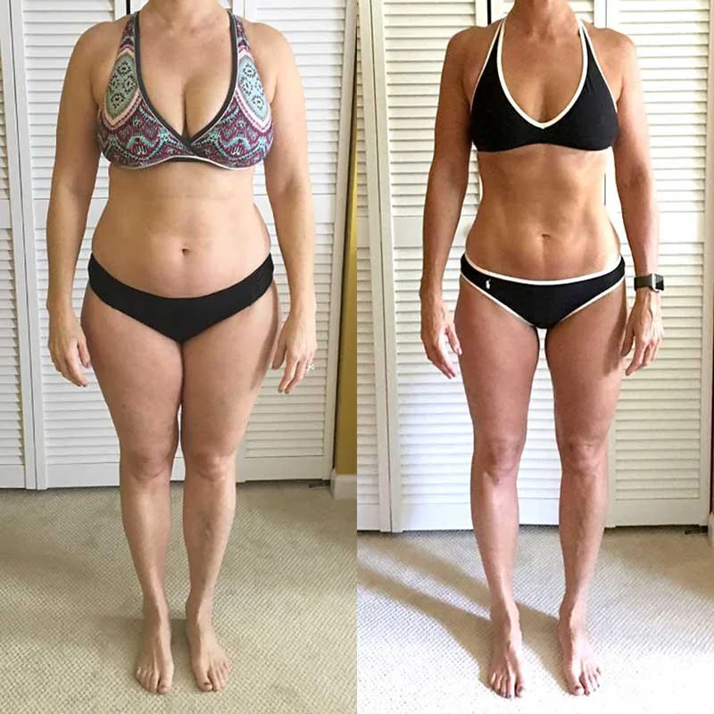 Reta pen transformation at 4 months